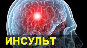 О проведении мероприятий посвященных Всемирному Дню борьбы с инсультом